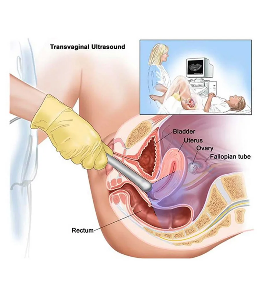pregnancy tests and safe abortion pregnancy tests and safe abortion